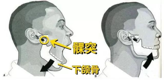 口腔健康科普|知名歌手摔倒,下巴受伤缝30针,摔到下巴后果为何如此严重!-健康知识-南方医科大学深圳口腔医院(坪山)