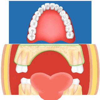 腺样体面容.gif