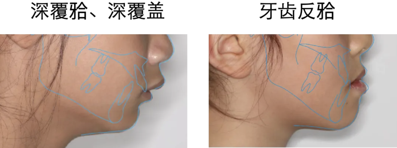 自动转存图片